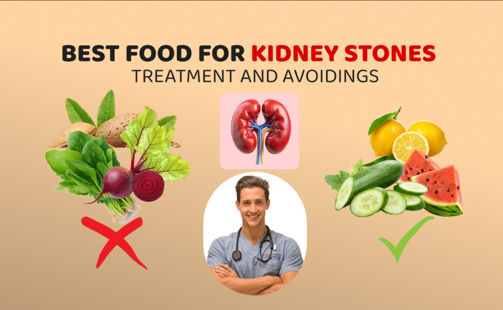Kidney Stones